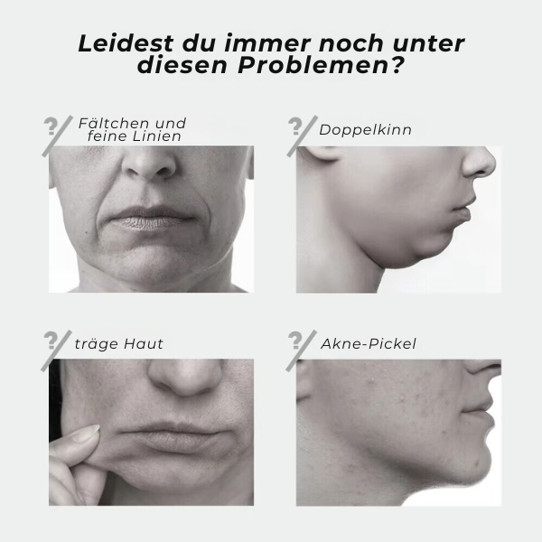 BYONA ViaLift EMS Massage - BeautyFlex