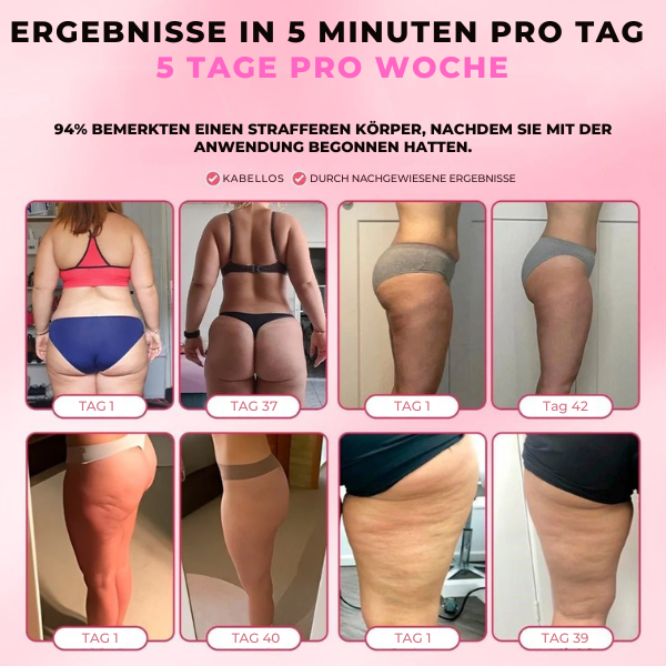 BYONA CelluPro Schröpfgerät