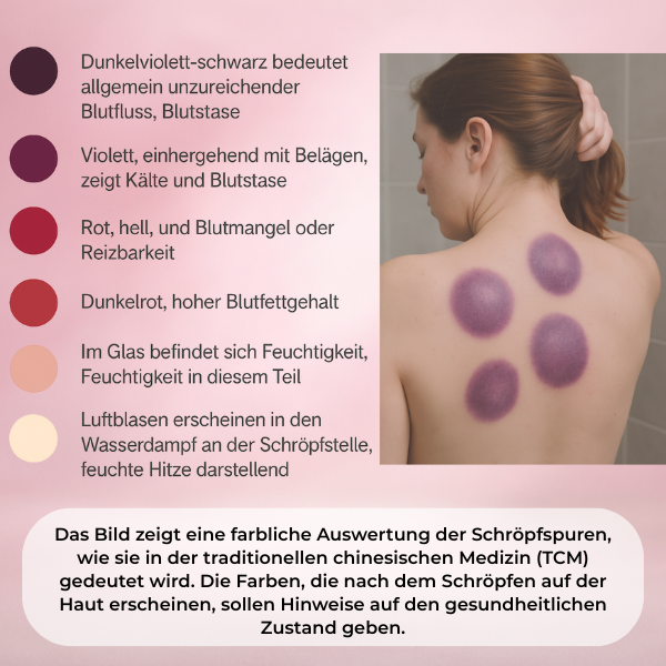 BYONA CelluPro Schröpfgerät