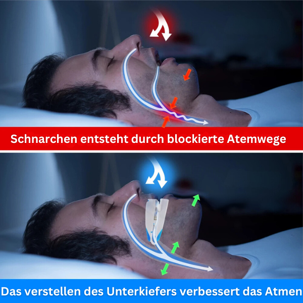 [70 %SPAREN] BYONA Schlafruhe - Deine Anti-Schnarch-Schiene